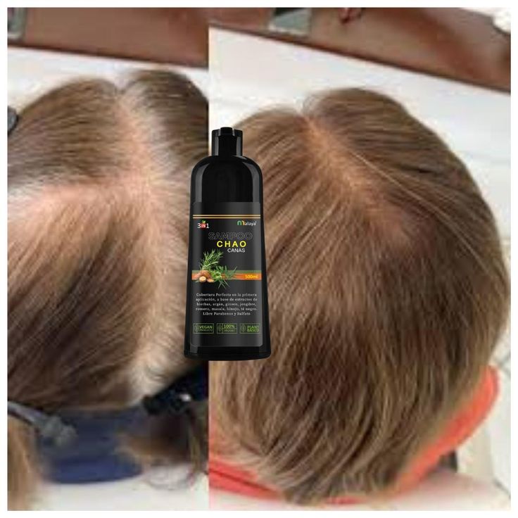 SHAMPOO CHAO CANAS